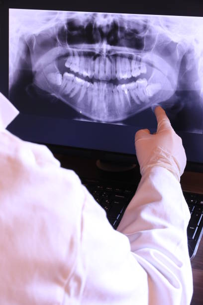 Best Root Canal Emergency Dentist  in Burton, SC