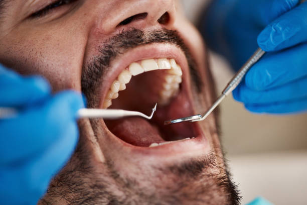 Dentist for Dental Trauma in SC