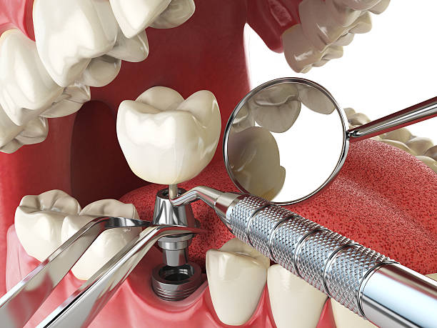 Best Emergency Gum Pain Relief  in Burton, SC